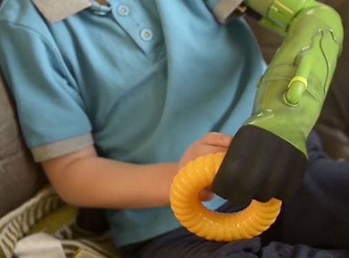 Un joven inglés tiene el mismo brazo robótico que Hulk